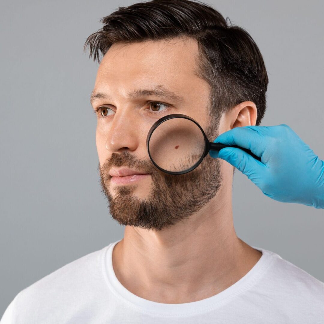 2D6T939 Doctor Hand Checking Face Skin Of Man With Dermatoscope